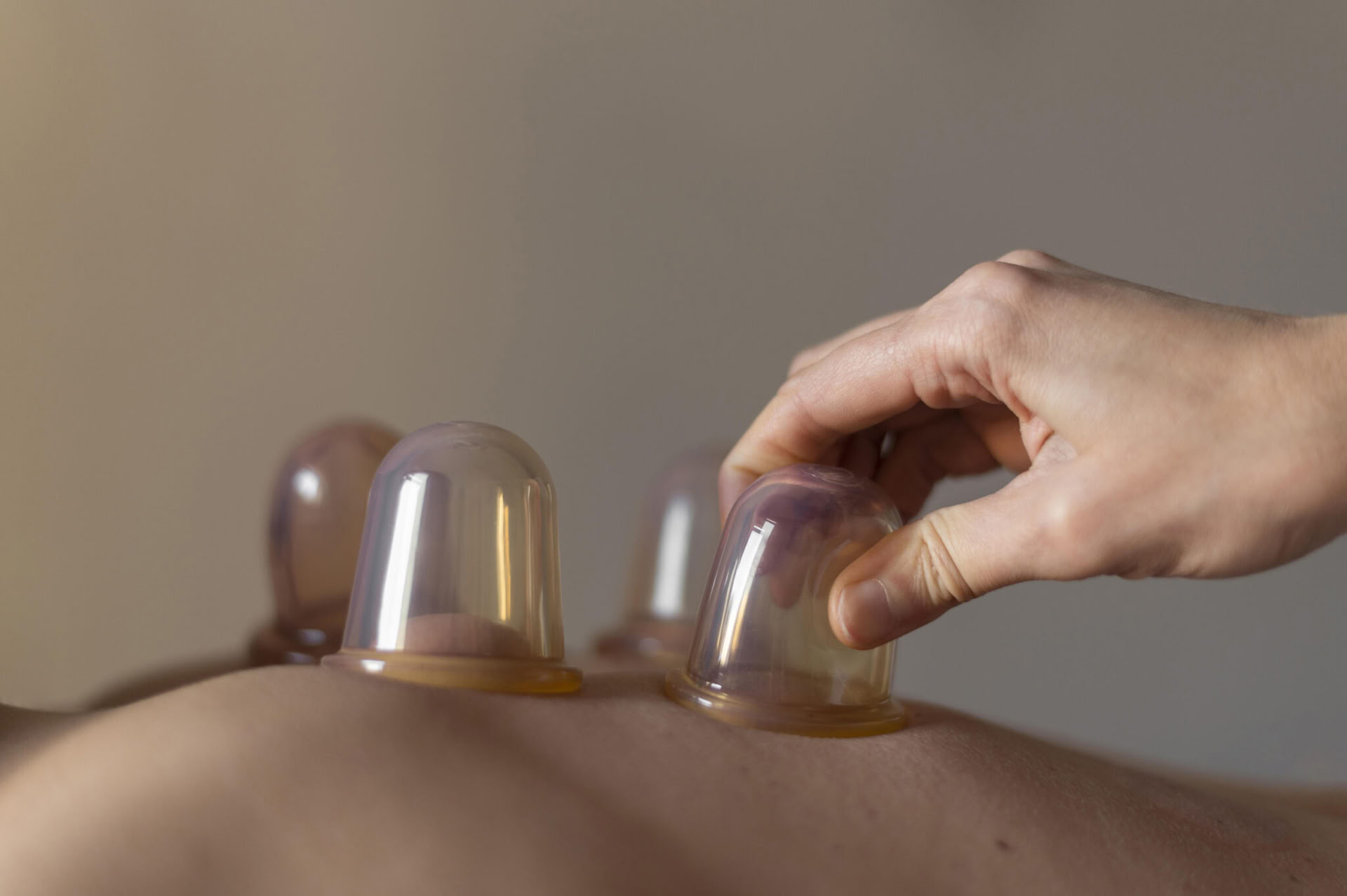 Massage par ventouses